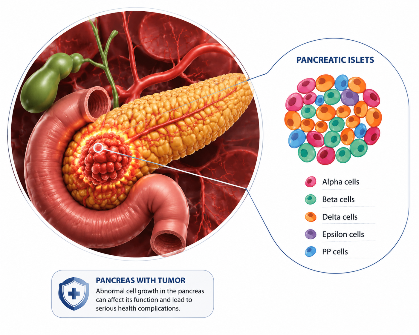 Pancreatic Cancer Oncology Care
